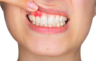 cirugía plástica periodontal
