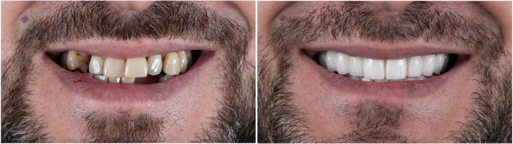 Especialistas dentales Barcelona